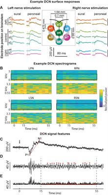 Peripheral Nerve Activation Evokes Machine-Learnable Signals in the Dorsal Column Nuclei
